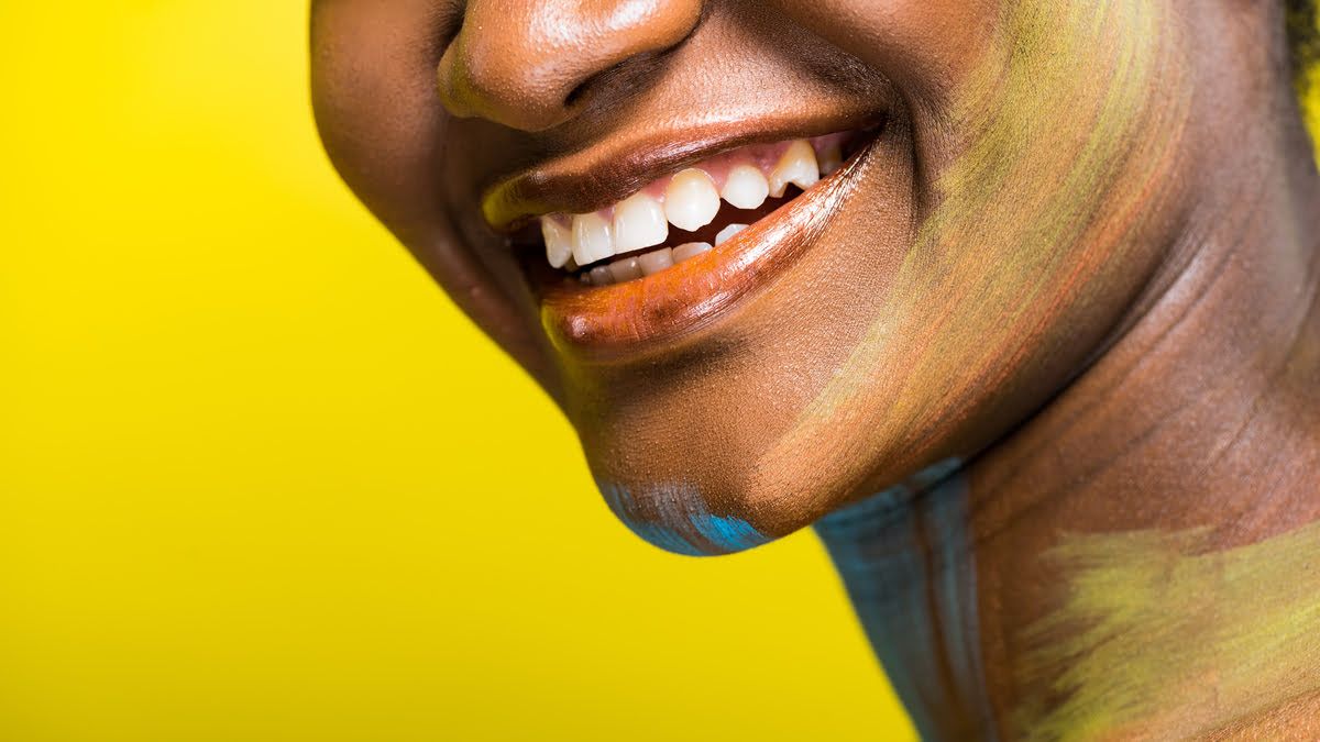 Bonding zębów | Co to i czy warto?